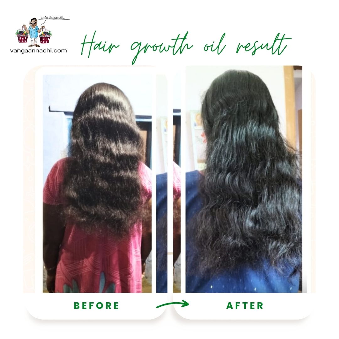 Hair Growth Oil ( Homemade Product)