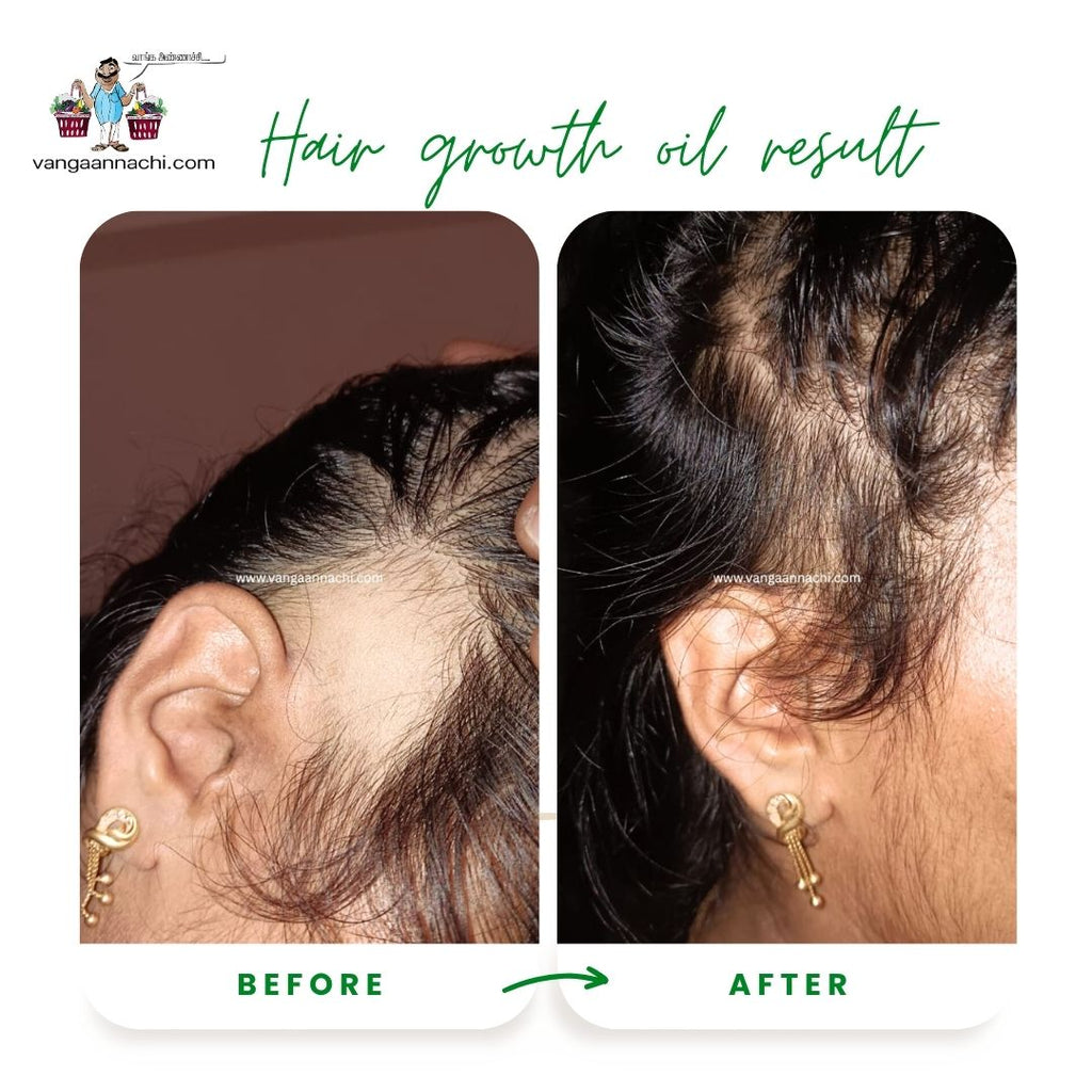 Hair Growth Oil ( Homemade Product)