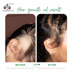 Hair Growth Oil ( Homemade Product)
