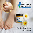 Herbal Foot Crack Balm – Siddha Formula | Deep Repair, Soft Skin & Pain Relief