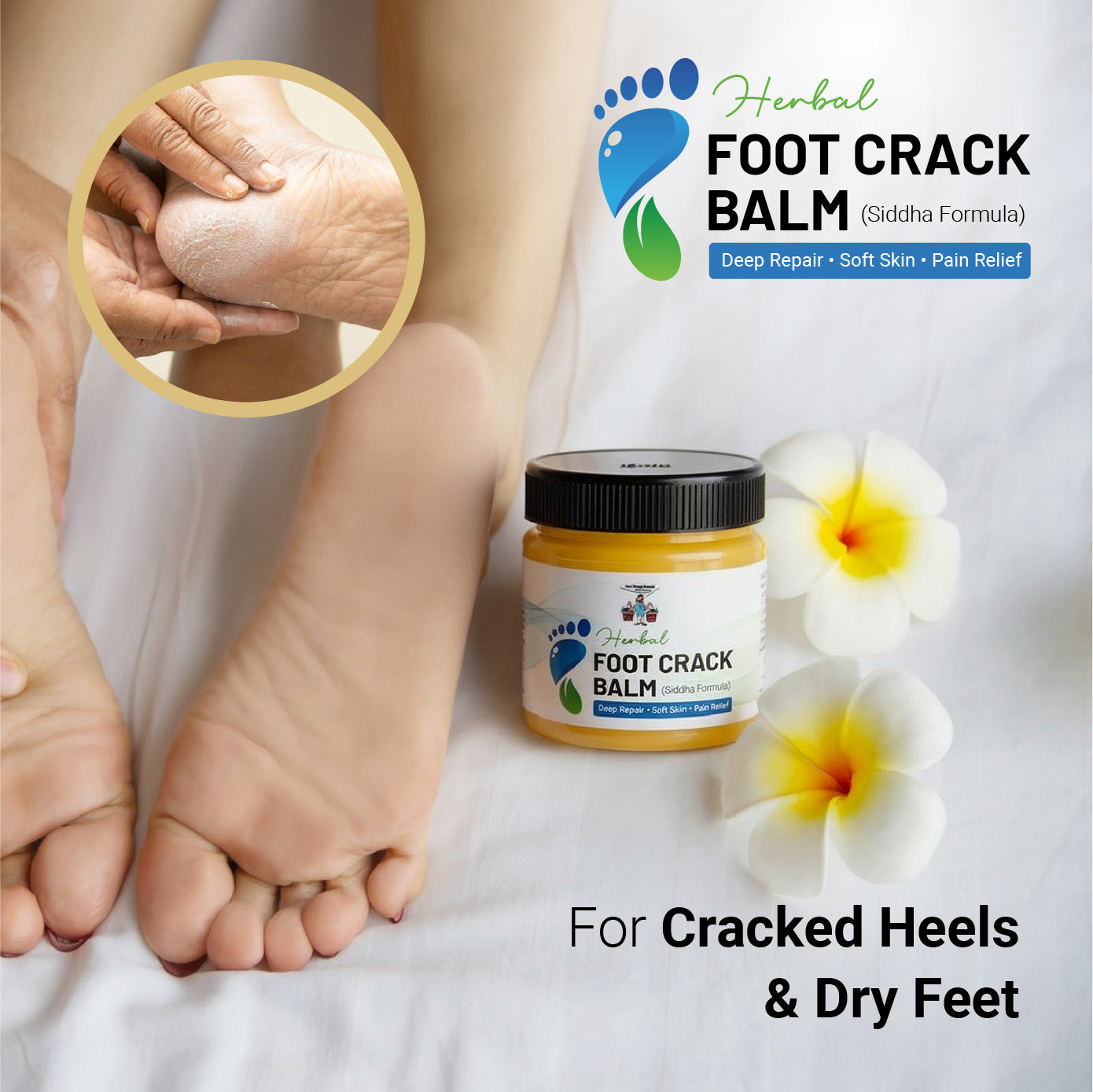 Herbal Foot Crack Balm – Siddha Formula | Deep Repair, Soft Skin & Pain Relief