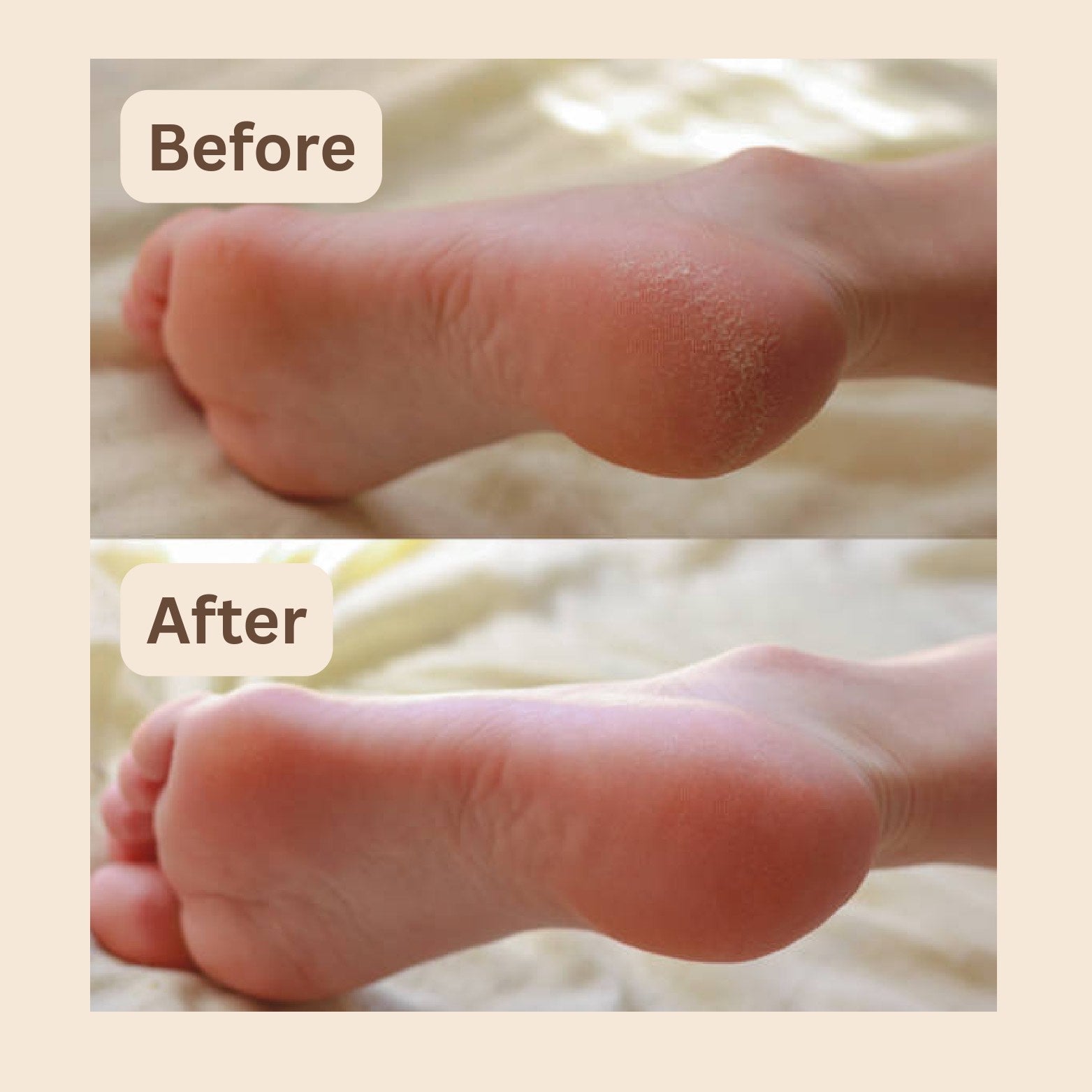 Feet fix cream